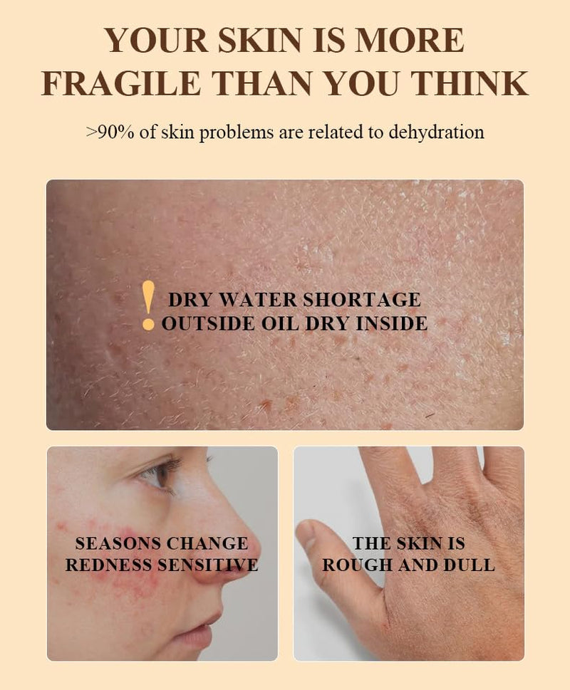 Tallow and Honey Balm for Skin Care - Grass-Fed Beef Tallow & Raw Wild Honey Blend - All Natural Moisturizing Body Oil (2 Oz)