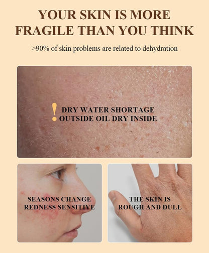 Tallow and Honey Balm for Skin Care - Grass-Fed Beef Tallow & Raw Wild Honey Blend - All Natural Moisturizing Body Oil (2 Oz)